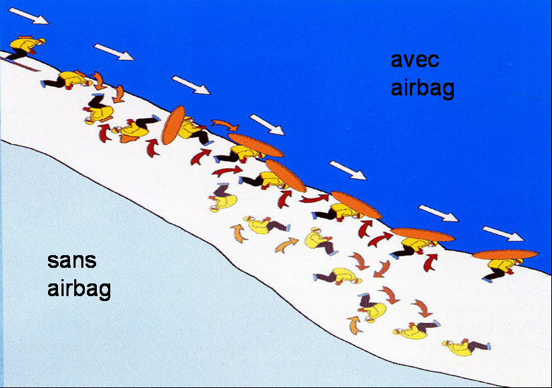 Le sac airbag gonflé